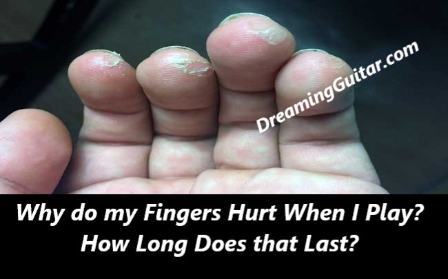 Why do my Fingers Hurt When I Play? How Long Does that Last?